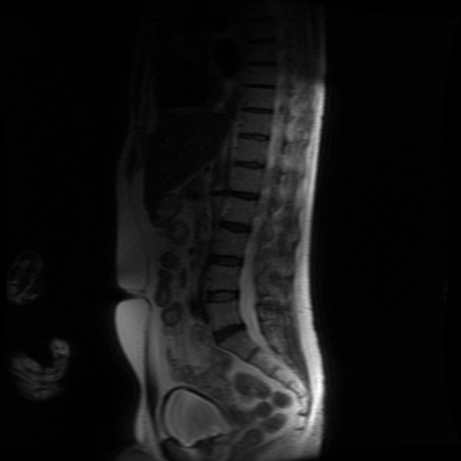 Bild uppladdad av Björn