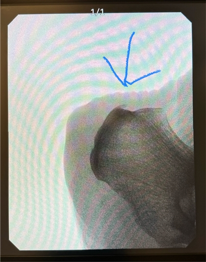 Bild uppladdad av Joakim