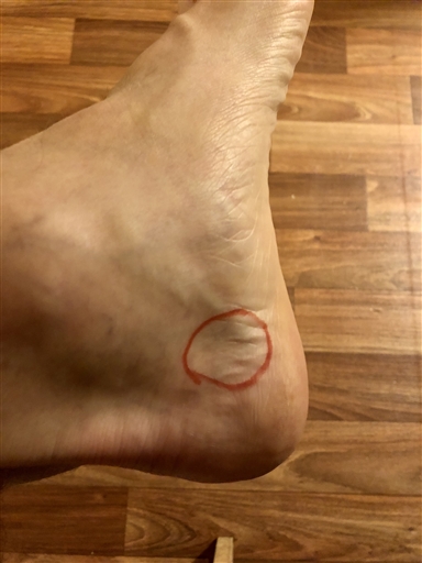 Bild uppladdad av Anonymiserad