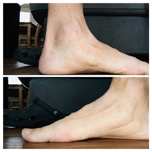 Bild uppladdad av Anonymiserad