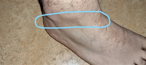 Bild uppladdad av Anonymiserad