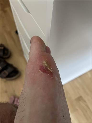 Bild uppladdad av Oskar