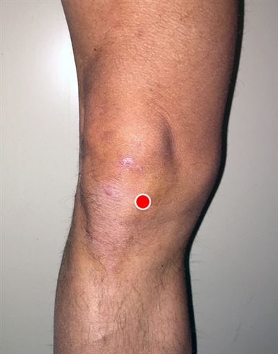 Bild uppladdad av Patrik Magnerius