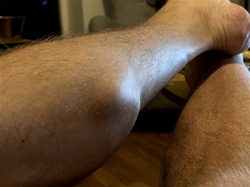 Bild uppladdad av Nicro