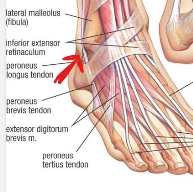 Bild uppladdad av Magnus Asplund