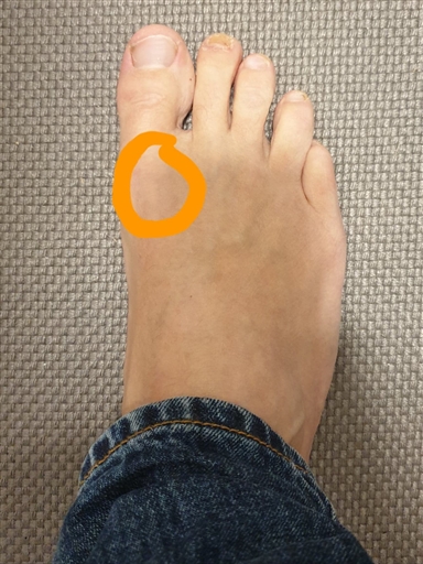 Bild uppladdad av Mikael Lipschütz 