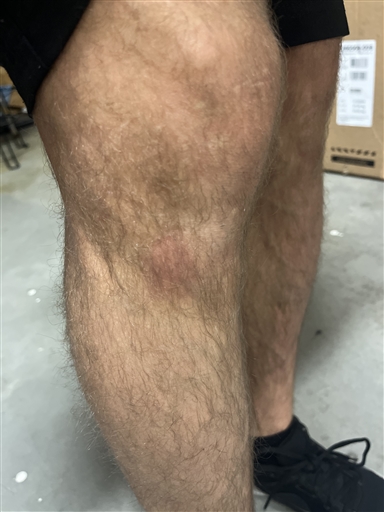 Bild uppladdad av Linus Einarsson