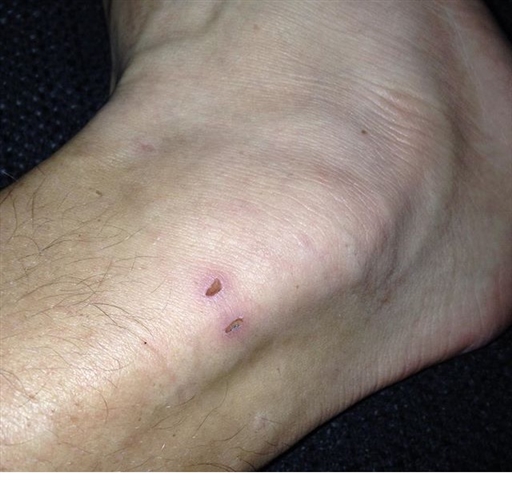 Bild uppladdad av Andreas Ericsson